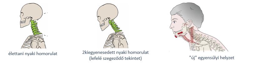 temporomandibularis izület gyulladása)
