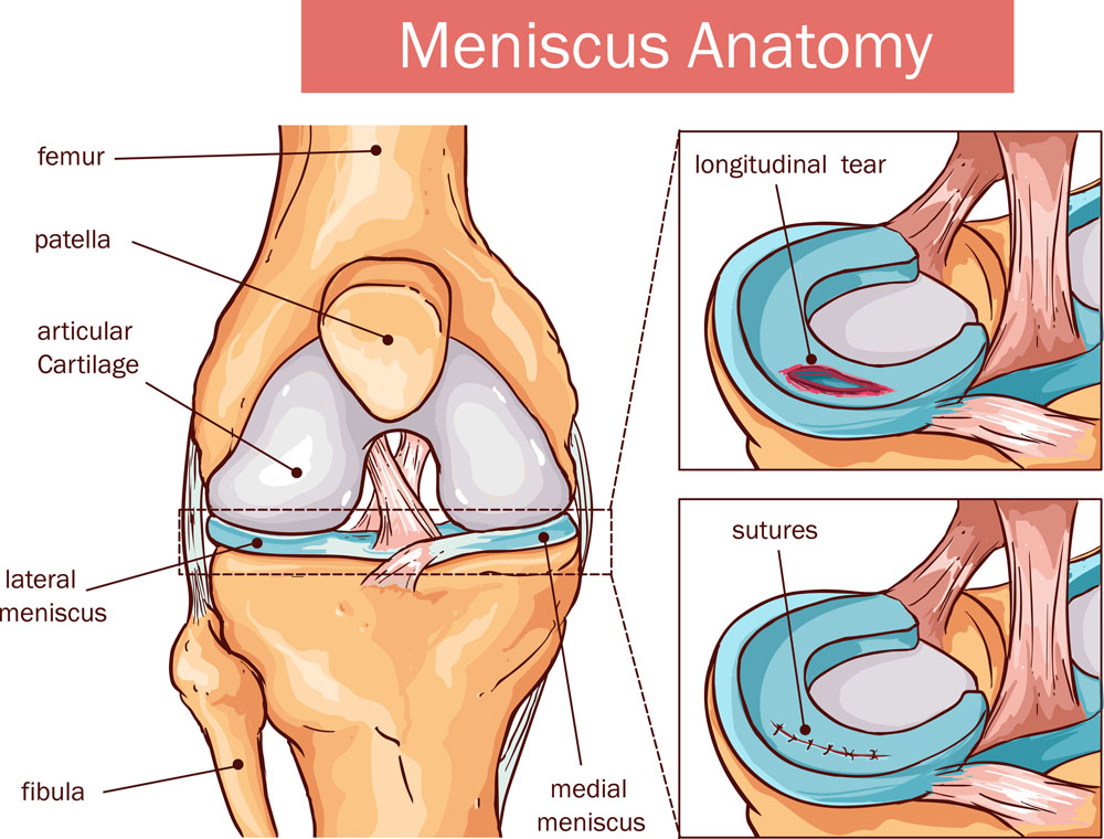 meniscus