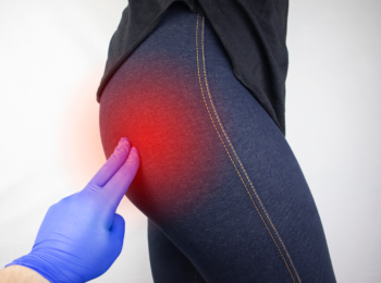 A piriformis szindróma: Megkérdeztük a gyógytornászt