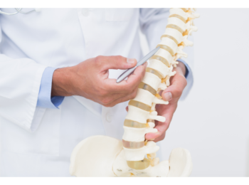 spondylosis